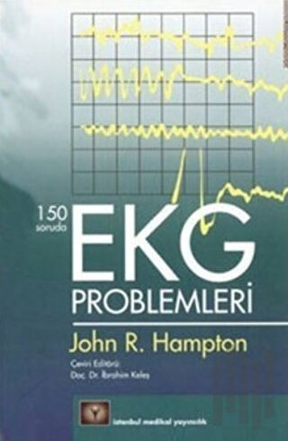150 Soruda EKG Problemleri
