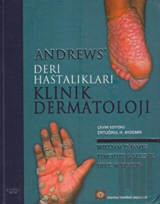 Andrews’ Deri Hastalıkları Klinik Dermatoloji (Ciltli)