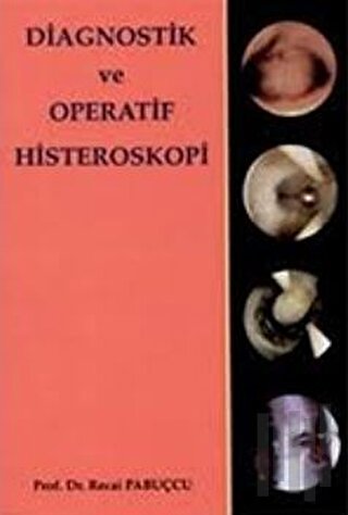 Diagnostik ve Operatif Histeroskopi (Ciltli) | Kitap Ambarı
