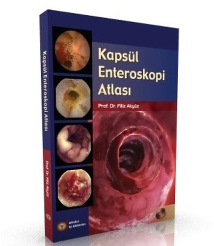 Kapsül Enteroskopi Atlası (Ciltli)