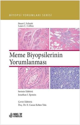 Meme Biyopsilerinin Yorumlanması (Ciltli)