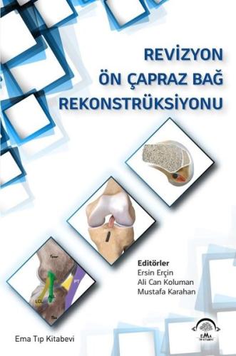 Revizyon Ön Çapraz Bağ Rekonstrüksiyonu | Kitap Ambarı