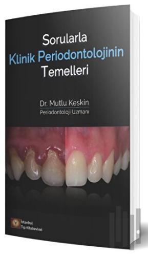 Sorularla Klinik Periodontolojinin Temelleri